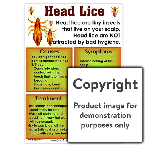 Head Lice Wall Charts And Posters