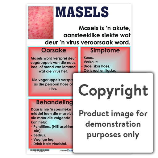 Masels Wall Charts And Posters