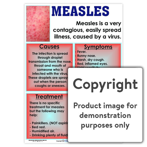 Measles Wall Charts And Posters