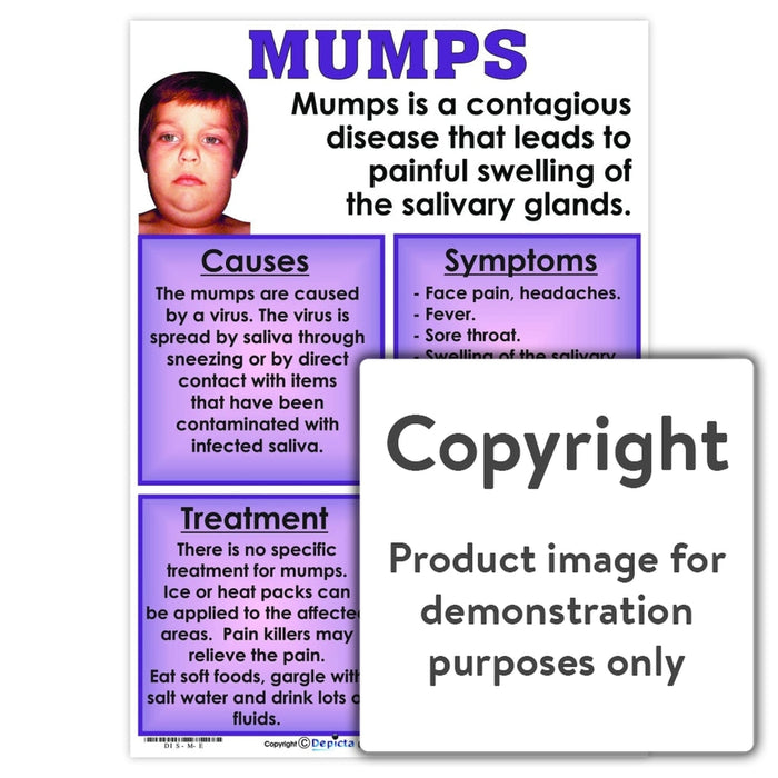 Mumps Wall Charts And Posters