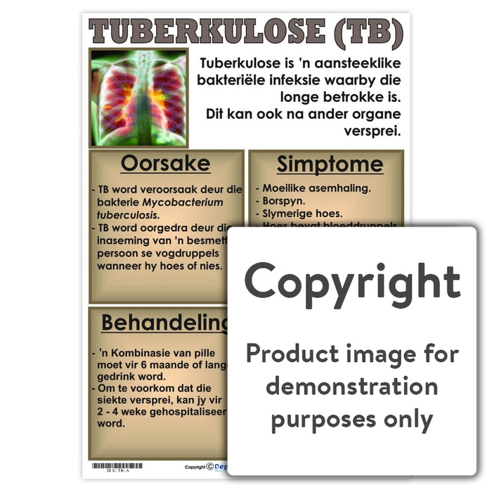 Tuberkulose (Tb) Wall Charts And Posters